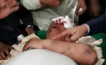 ফুলের তোড়া ভাঙা নিয়ে সংঘর্ষে চেয়ারম্যানসহ আহত ১০